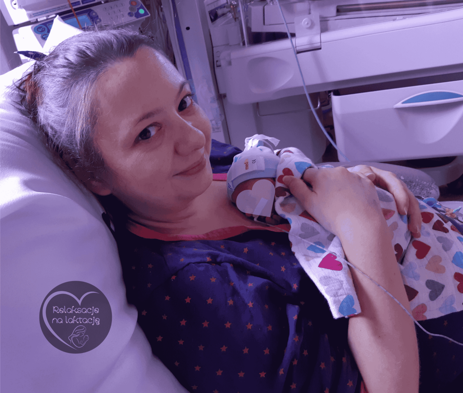 kangurowanie wcześniaka na OION neonatologia
